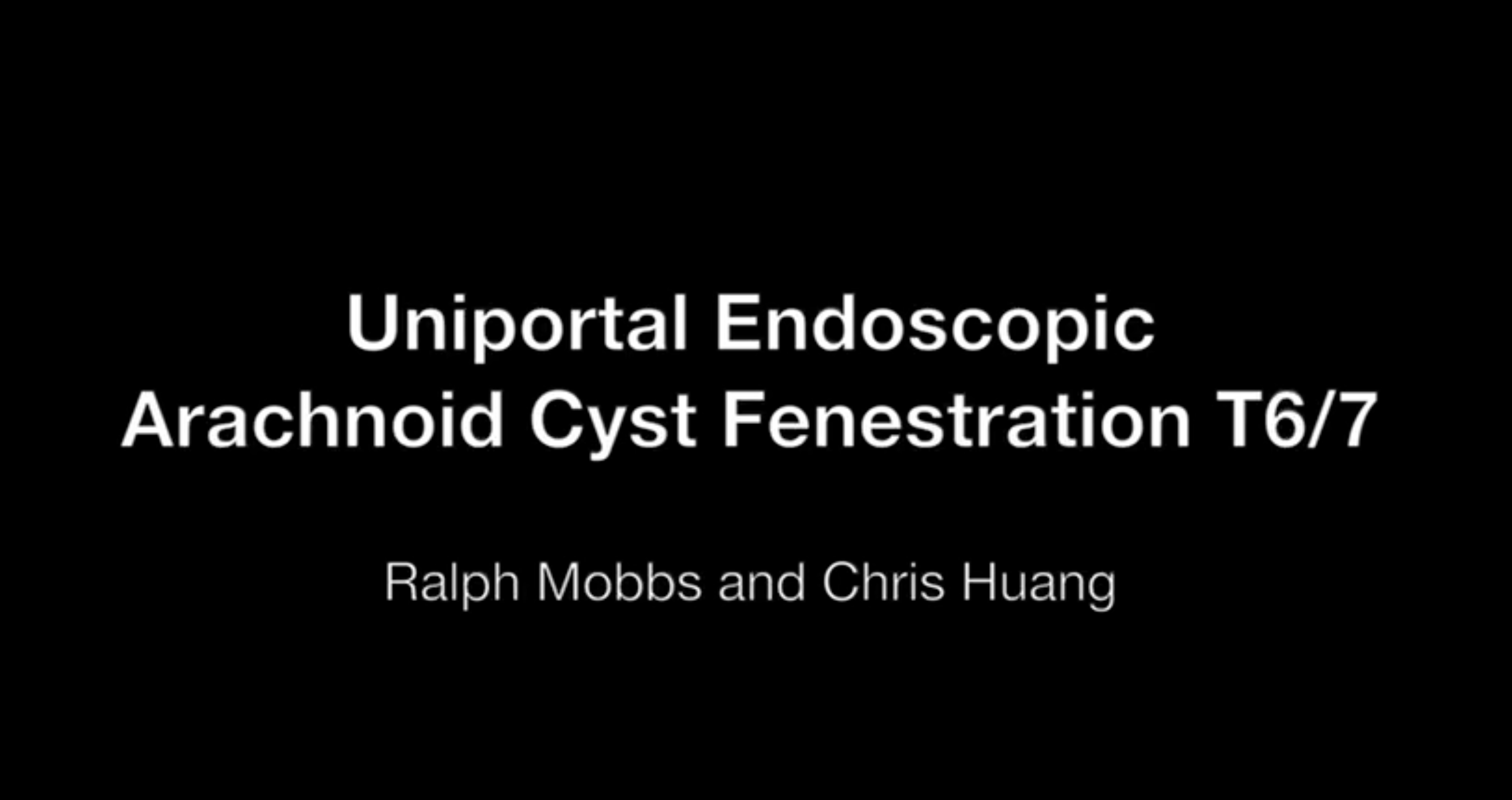 Uniportal Endoscopic Arachnoid Cyst Fenestration T6/7 | EndoSpine